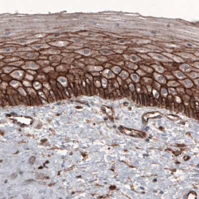Immunohistochemistry: beta-Catenin Antibody (CL3689) [NBP2-61628]