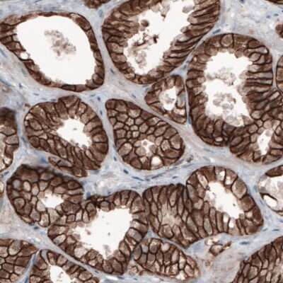 Immunohistochemistry-Paraffin: beta-Catenin Antibody (CL3689) [NBP2-61628]