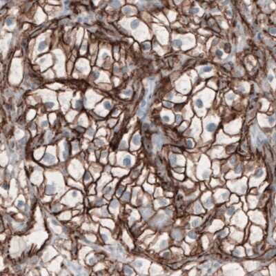 Immunohistochemistry-Paraffin: beta-Catenin Antibody (CL3689) [NBP2-61628]