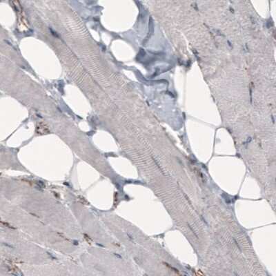 Immunohistochemistry-Paraffin: beta-Catenin Antibody (CL3689) [NBP2-61628]