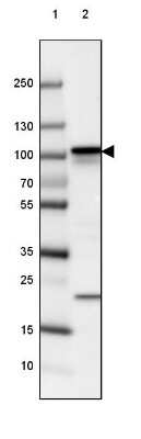 Western Blot: beta-Catenin Antibody (CL3689) [NBP2-61628]