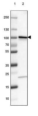 Western Blot: beta-Catenin Antibody (CL3689) [NBP2-61628]