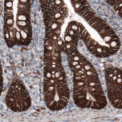 Immunohistochemistry: beta-Catenin Antibody (CL3691) [NBP2-61629]