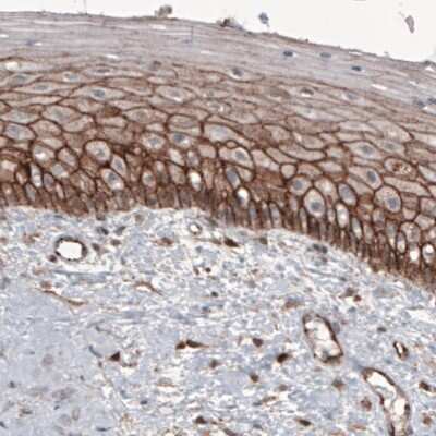 Immunohistochemistry: beta-Catenin Antibody (CL3691) [NBP2-61629]