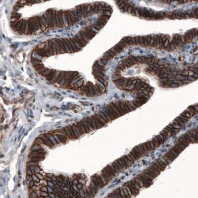 Immunohistochemistry: beta-Catenin Antibody (CL3691) [NBP2-61629]