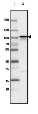 Western Blot: beta-Catenin Antibody (CL3691) [NBP2-61629]