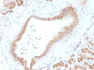 Immunohistochemistry-Paraffin: beta-Catenin Antibody (CTNNB1/1507) - Azide and BSA Free [NBP2-54542]