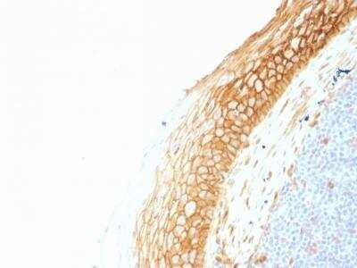 Immunohistochemistry-Paraffin: beta-Catenin Antibody (CTNNB1/1507) - Azide and BSA Free [NBP2-54542]