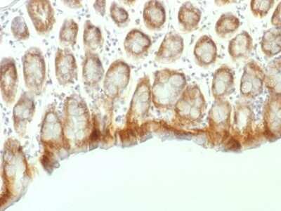 Immunohistochemistry-Paraffin: beta-Catenin Antibody (CTNNB1/1507) [NBP2-53361]