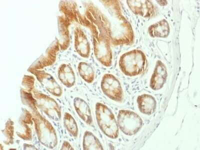 Immunohistochemistry-Paraffin: beta-Catenin Antibody (CTNNB1/1507) [NBP2-53361]