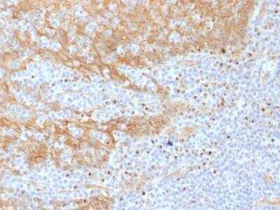 Immunohistochemistry-Paraffin: beta-Catenin Antibody (CTNNB1/1508) - Azide and BSA Free [NBP2-54541]