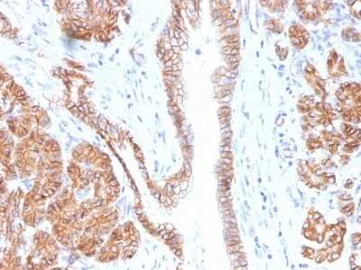Immunohistochemistry-Paraffin: beta-Catenin Antibody (CTNNB1/1508) [NBP2-53365]