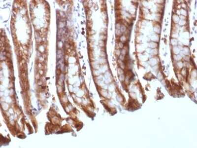 Immunohistochemistry-Paraffin: beta-Catenin Antibody (CTNNB1/1508) [NBP2-53365]