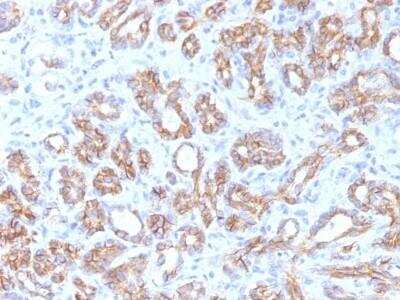 Immunohistochemistry-Paraffin: beta-Catenin Antibody (CTNNB1/1509) - Azide and BSA Free [NBP2-54540]