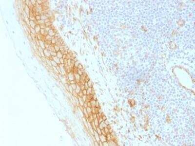 Immunohistochemistry-Paraffin: beta-Catenin Antibody (CTNNB1/1509) - Azide and BSA Free [NBP2-54540]
