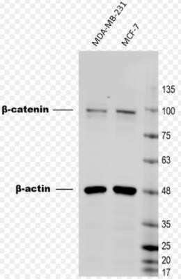 Western Blot: beta-Catenin Antibody (CTNNB1/1509)Azide and BSA Free [NBP2-54540]