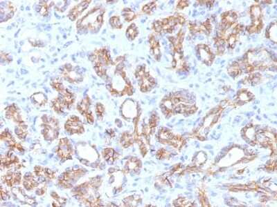 Immunohistochemistry-Paraffin: beta-Catenin Antibody (CTNNB1/1509) [NBP2-53366]