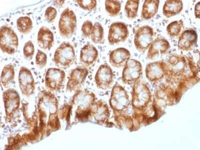 Immunohistochemistry-Paraffin: beta-Catenin Antibody (CTNNB1/1509) [NBP2-53366]