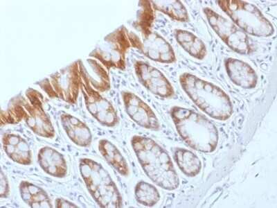 Immunohistochemistry-Paraffin: beta-Catenin Antibody (CTNNB1/1509) [NBP2-53366]