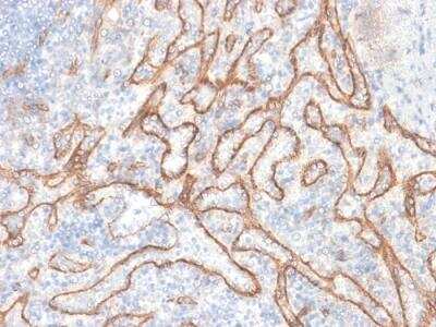 Immunohistochemistry-Paraffin: beta-Catenin Antibody (CTNNB1/2030R) - Azide and BSA Free [NBP2-79888]