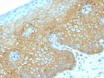 Immunohistochemistry-Paraffin: beta-Catenin Antibody (CTNNB1/2030R) - Azide and BSA Free [NBP2-79888]