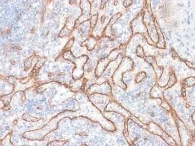 Immunohistochemistry-Paraffin: beta-Catenin Antibody (CTNNB1/2030R) [NBP2-79753]