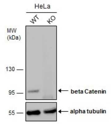 Western Blot: beta-Catenin Antibody (GT2169) [NBP3-13530]