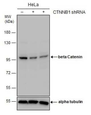 Western Blot: beta-Catenin Antibody (GT2169) [NBP3-13530]