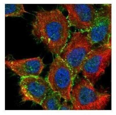 Immunocytochemistry/ Immunofluorescence: beta-Catenin Antibody [NBP1-32239]