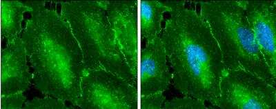 Immunocytochemistry/ Immunofluorescence: beta-Catenin Antibody [NBP1-32239]