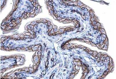 Immunohistochemistry-Paraffin: beta-Catenin Antibody [NBP1-32239]