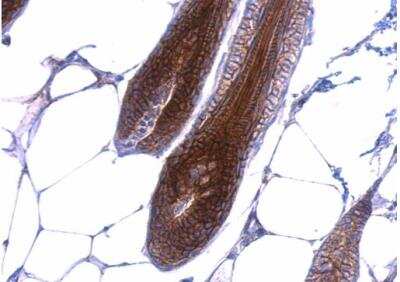 Immunohistochemistry-Paraffin: beta-Catenin Antibody [NBP1-32239]