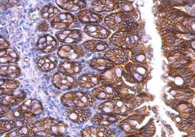 Immunohistochemistry-Paraffin: beta-Catenin Antibody [NBP1-32239]