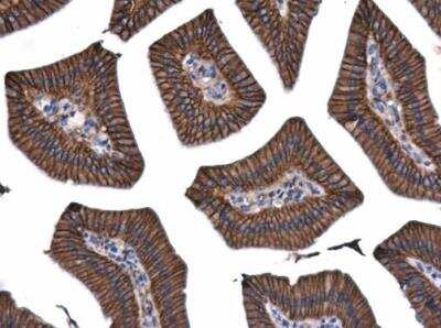 Immunohistochemistry-Paraffin: beta-Catenin Antibody [NBP1-32239]