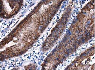 Immunohistochemistry-Paraffin: beta-Catenin Antibody [NBP1-32239]