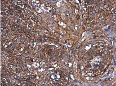 Immunohistochemistry-Paraffin: beta-Catenin Antibody [NBP1-32239]
