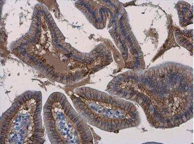 Immunohistochemistry-Paraffin: beta-Catenin Antibody [NBP1-32239]