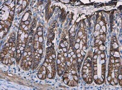 Immunohistochemistry-Paraffin: beta-Catenin Antibody [NBP1-32239]