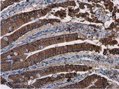 Immunohistochemistry-Paraffin: beta-Catenin Antibody [NBP1-32239]