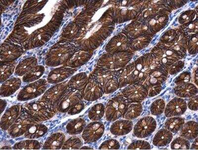 Immunohistochemistry-Paraffin: beta-Catenin Antibody [NBP1-32239]