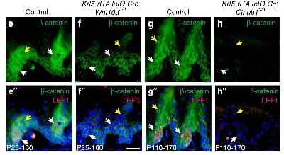 Immunohistochemistry-Paraffin: beta-Catenin Antibody [NBP1-32239]