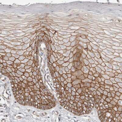 Immunohistochemistry-Paraffin: beta-Catenin Antibody [NBP1-89989]