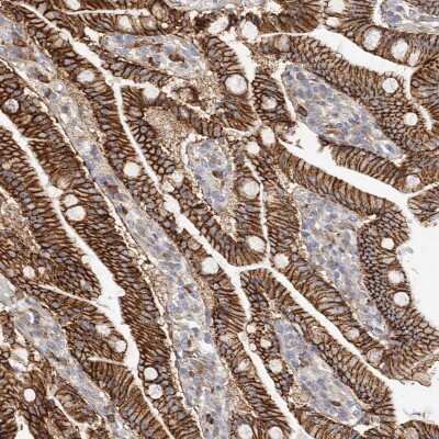Immunohistochemistry-Paraffin: beta-Catenin Antibody [NBP1-89989]