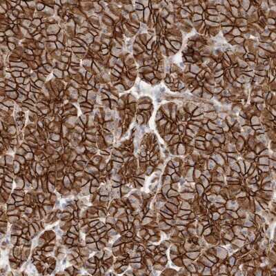 Immunohistochemistry-Paraffin: beta-Catenin Antibody [NBP1-89989]