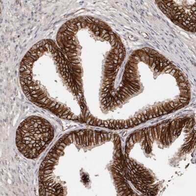 Immunohistochemistry-Paraffin: beta-Catenin Antibody [NBP1-89989]