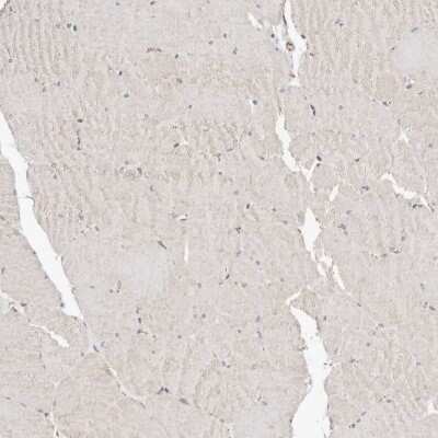 Immunohistochemistry-Paraffin: beta-Catenin Antibody [NBP1-89989]