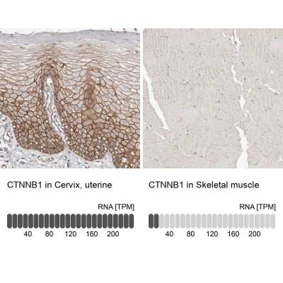 Immunohistochemistry-Paraffin: beta-Catenin Antibody [NBP1-89989]