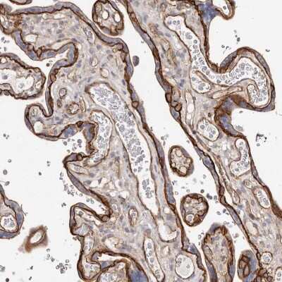 Immunohistochemistry-Paraffin: beta-Catenin Antibody [NBP1-89990]