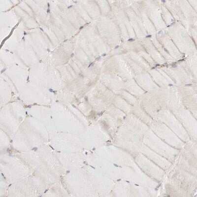Immunohistochemistry-Paraffin: beta-Catenin Antibody [NBP1-89990]