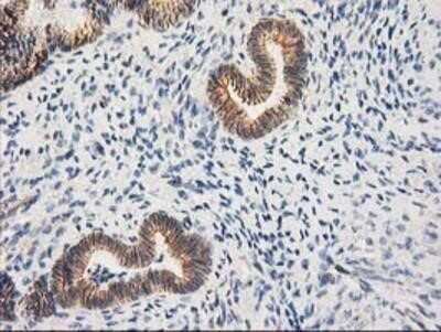 Immunohistochemistry: beta-Catenin Antibody (OTI12H7) - Azide and BSA Free [NBP2-70509]